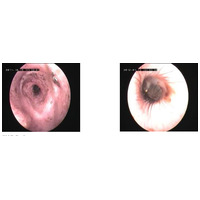 Dermoscent PYOclean Oto kutyáknak, macskáknak és nyulaknak #10