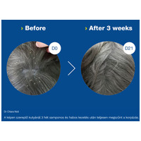 Douxo S3 Seb sampon kutyáknak és macskáknak #3